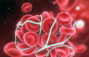 श्वेत रक्त कणिकाओं की कमी से हो सकतीं यह बीमारियां, जानें कैसे ब्लड में बढ़ाई जा सकते हैं ये सेल्स