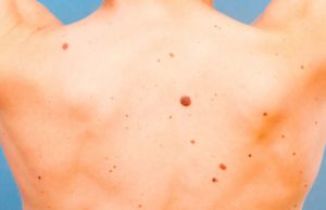 ज्यादा धूप सेंकना सेहत के लिए नुकसानदायक