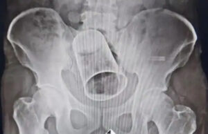 उड़ीसा के ब्रहृमपुत्र में हुई एक अजीबो गरीब घटना